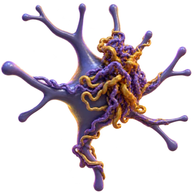 Amyloid beta lesson
