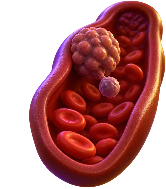 Metastasis lesson